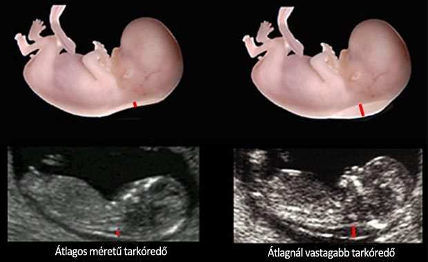 svájci öregedésgátló morfológiai ultrahang